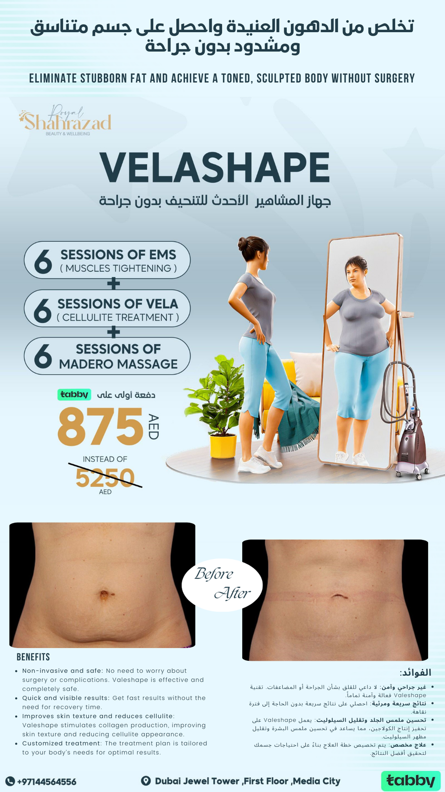 Velashape